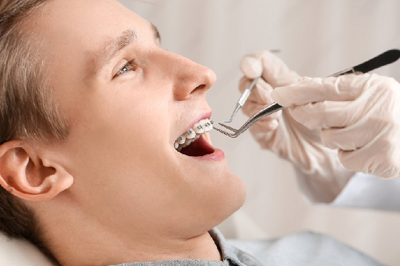 kolejność ortodoncja
